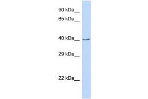 Host:  Rabbit  Target Name:  CDS2  Sample Type:  293T Whole cell lysates  Antibody Dilution:  1. (CDS2 antibody  (C-Term))