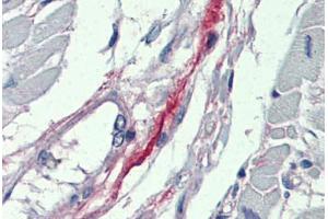 Heart, Human: Formalin-Fixed, Paraffin-Embedded (FFPE) (DDAH2 antibody  (N-Term))