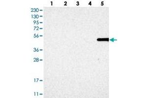 Western blot analysis of Lane 1: RT-4, Lane 2: U-251 MG, Lane 3: Human Plasma, Lane 4: Liver, Lane 5: Tonsil with MFSD6L polyclonal antibody . (MFSD6L antibody)