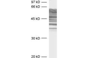 Western Blotting (WB) image for anti-tau Protein (AA 3-214) antibody (ABIN1742569) (tau antibody  (AA 3-214))