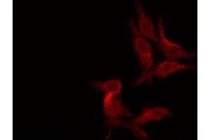 ABIN6276106 staining Hela by IF/ICC. (OPRK1 antibody  (N-Term))