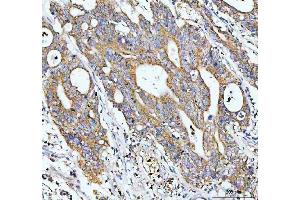 IHC analysis of GCLC using anti-GCLC antibody (ABIN3042420).
