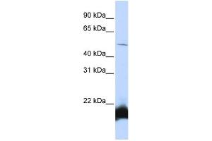 WB Suggested Anti-ONECUT1 Antibody Titration:  0. (ONECUT1 antibody  (N-Term))