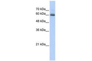 Image no. 1 for anti-Sema Domain, Immunoglobulin Domain (Ig), Transmembrane Domain (TM) and Short Cytoplasmic Domain, (Semaphorin) 4F (SEMA4F) (AA 21-70) antibody (ABIN6740971) (SEMA4F antibody  (AA 21-70))