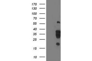 HEK293T cells were transfected with the pCMV6-ENTRY control (Left lane) or pCMV6-ENTRY LENG1 (Right lane) cDNA for 48 hrs and lysed. (Leng1 antibody)