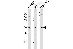 All lanes : Anti-CRYZ Antibody (C-term) at 1:2000 dilution Lane 1: HepG2 whole cell lysates Lane 2: mouse brain lysates Lane 3: U-87-MG whole cell lysates Lysates/proteins at 20 μg per lane. (CRYZ antibody  (C-Term))