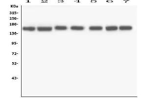 Western blot analysis of RNF123 using anti-RNF123 antibody (ABIN6719387). (RNF123 antibody  (AA 12-188))