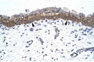 Human Skin (ZNF385A antibody  (C-Term))