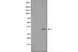 Western blot analysis on HepG2 cell lysate using MAGE-1 Antibody,The lane on the left is treated with the antigen-specific peptide. (MAGEA1 antibody  (C-Term))