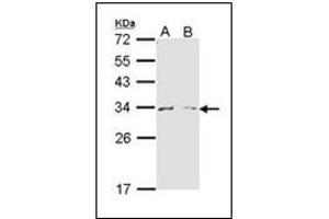 Western Blot analysis using ARG1 antibody at 1/1000 dilution. (Liver Arginase antibody  (AA 1-145))