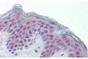 Human Skin (POLDIP3 antibody  (C-Term))