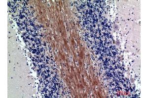 Immunohistochemistry (IHC) analysis of paraffin-embedded Human Brain, antibody was diluted at 1:200. (SIRP-Alpha1/beta1 (Internal Region) antibody)