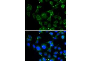 Immunofluorescence analysis of HeLa cell using MAPRE2 antibody. (MAPRE2 antibody)