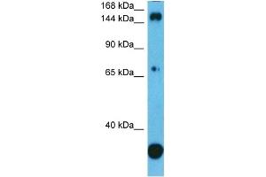 Host:  Rabbit  Target Name:  PLCG1  Sample Type:  PANC1 Whole Cell  Antibody Dilution:  1. (Phospholipase C gamma 1 antibody  (C-Term))