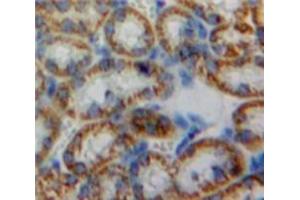 Used in DAB staining on fromalin fixed paraffin-embedded Kidney tissue (HMOX2 antibody  (AA 71-306))
