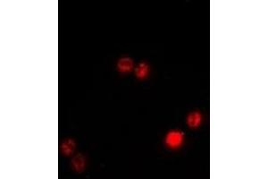 Immunofluorescent analysis of BAF53B staining in A549 cells. (Actin-Like 6B antibody)