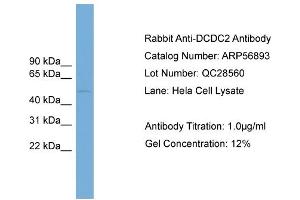 WB Suggested Anti-DCDC2  Antibody Titration: 0. (DCDC2 antibody  (Middle Region))
