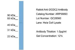 WB Suggested Anti-DCDC2  Antibody Titration: 0.