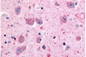 Anti-BAI2 antibody  ABIN1048341 IHC staining of human brain, neurons and glia. (BAI2 antibody  (N-Term))
