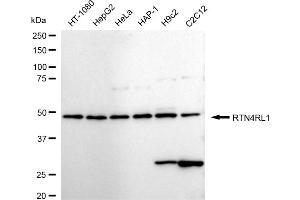Western blotting analysis using RTN4RL1 antibody (ABIN7800181).