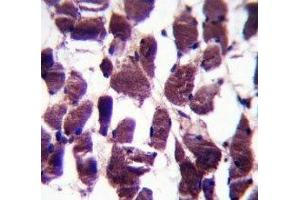 LRIG2 antibody immunohistochemistry analysis in formalin fixed and paraffin embedded human skeletal muscle. (LRIG2 antibody  (AA 817-845))