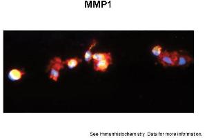 Sample Type: Human Macrophange CellsGreen: primaryRed: phallodinBlue: DAPIYellow: green/redPrimary Dilution: 1:200Secondary Antibody: anti-Rabbit IgG-FITCSecondary Dilution: 1:1000Image Submitted By: Milan FialaUniversity of California, Los Angeles (MMP1 antibody  (C-Term))