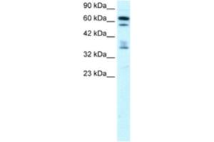 Western Blotting (WB) image for anti-Zinc Finger Protein 512 (ZNF512) antibody (ABIN2460159)