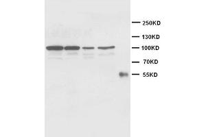 Western Blotting (WB) image for anti-Cadherin 2 (CDH2) antibody (ABIN1105630) (N-Cadherin antibody)