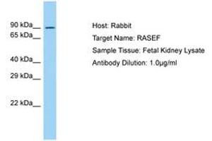 Image no. 1 for anti-RAS and EF Hand Domain Containing (RASEF) (AA 194-243) antibody (ABIN6750067) (RASEF antibody  (AA 194-243))