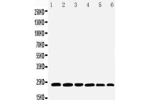 Anti-SNAP23 antibody, Western blotting Lane 1: Rat Spleen Tissue Lysate Lane 2: Rat testis Tissue Lysate Lane 3: Rat Ovary Tissue Lysate Lane 4: HELA Cell Lysate Lane 5: MCF-7 Cell Lysate Lane 6: SKOV Cell Lysate (SNAP23 antibody  (C-Term))