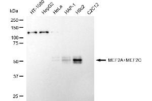 Western blotting analysis using MEF2A+MEF2C antibody (ABIN7799353).