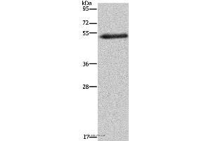 Western blot analysis of Human breast infiltrative duct tissue, using FOXC2 Polyclonal Antibody at dilution of 1:733 (FOXC2 antibody)