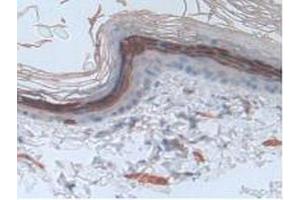 IHC-P analysis of Rat Skin Tissue, with DAB staining. (Involucrin antibody  (AA 461-551))