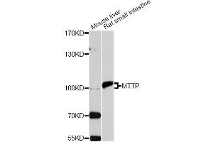 Western blot analysis of extracts of various cell lines, using MTTP antibody. (MTTP antibody)