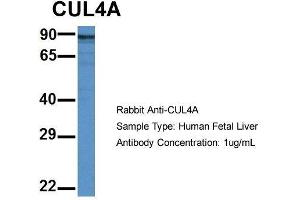 Host: Rabbit  Target Name: CUL4A  Sample Tissue: Human Fetal Liver  Antibody Dilution: 1. (Cullin 4A antibody  (Middle Region))