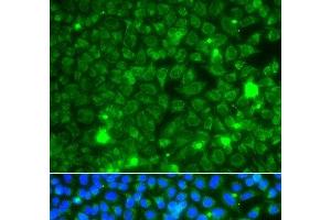 Immunofluorescence analysis of A549 cells using GBA3 Polyclonal Antibody (GBA3 antibody)