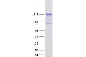 Validation with Western Blot (MRVI1 Protein (Transcript Variant 1) (Myc-DYKDDDDK Tag))