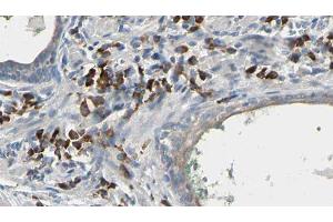 ABIN6277241 at 1/100 staining Human prostate tissue by IHC-P. (HNMT antibody  (Internal Region))