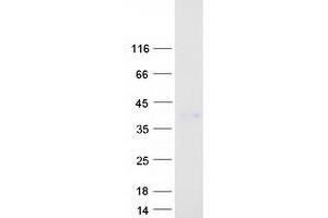 Validation with Western Blot
