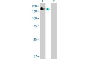 Western Blot analysis of IGF1R expression in transfected 293T cell line by IGF1R MaxPab polyclonal antibody.