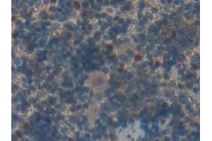 Detection of FGFRL1 in Rat Spleen Tissue using Polyclonal Antibody to Fibroblast Growth Factor Receptor Like Protein 1 (FGFRL1)