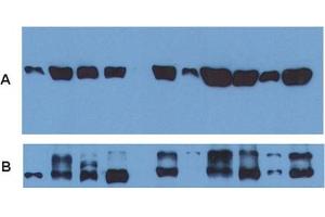Use of alpha Tubulin monoclonal antibody, clone TU-01  as a loading control (A) in an Western blotting experiment revealing the staining pattern of various cell lysates by a newly developed monoclonal antibody (B). (alpha Tubulin antibody)