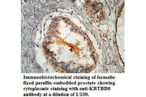 Image no. 1 for anti-Kelch Repeat and BTB (POZ) Domain Containing 8 (KBTBD8) antibody (ABIN1577436) (KBTBD8 antibody)