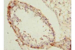 Immunohistochemistry of paraffin-embedded human testis tissue using ABIN7154259 at dilution of 1:100 (NMT2 antibody  (AA 1-120))