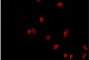 ABIN6269400 staining HeLa cells by IF/ICC. (HDAC6 antibody  (N-Term))