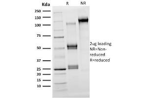 SDS-PAGE Analysis Purified OLIG2 Mouse Monoclonal Antibody (OLIG2/2400). (OLIG2 antibody  (AA 1-141))