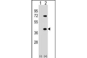 Western blot analysis of HNRN (arrow) using rabbit polyclonal HNRN Antibody (C-term) (ABIN1536971 and ABIN2848645). (HNRNPA1 antibody  (C-Term))