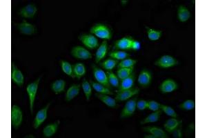 Immunofluorescence staining of A549 cells with ABIN7159070 at 1:100, counter-stained with DAPI. (MMP28 antibody  (AA 351-475))