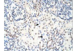 Image no. 2 for anti-HKR1, GLI-Kruppel Zinc Finger Family Member (HKR1) (C-Term) antibody (ABIN6736165) (HKR1 antibody  (C-Term))