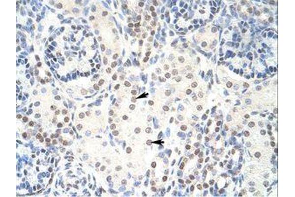 HKR1 antibody  (C-Term)